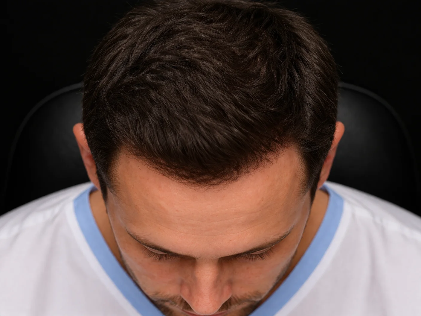 Nachher – Patient 2